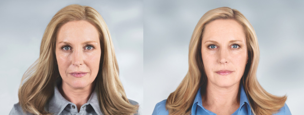 sculptra charleston, sc