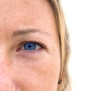 eyelid surgery charleston